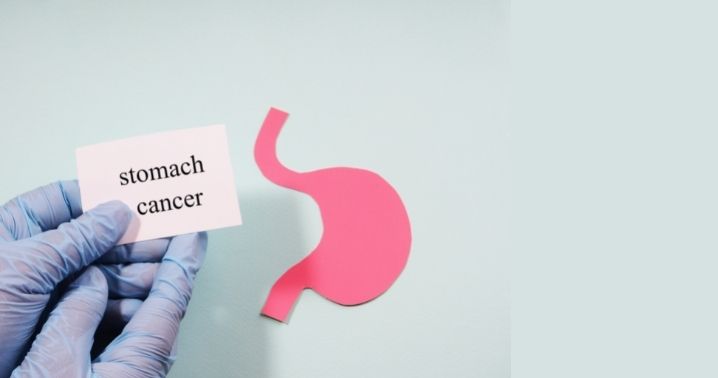 Stomach Cancer